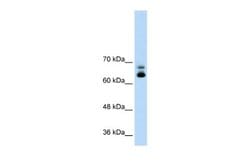 MTA2 Antibody, Novus Biologicals 100 &mu;L; Unconjugated:Antibodies, Polyclonal